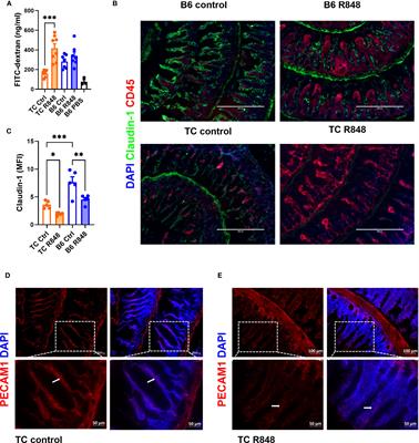 TLR7/TLR8 activation and susceptibility genes synergize to breach gut barrier in a mouse model of lupus